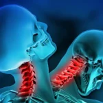 Whiplash Isn’t Just Neck Pain: The Hidden Effects After a Car Accident